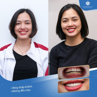 Khách hàng Lê Thị Hằng